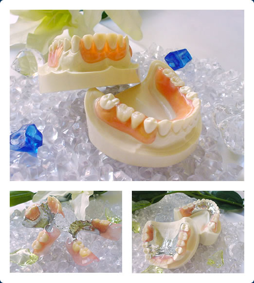 ノンクラスプデンチャーの3大特徴